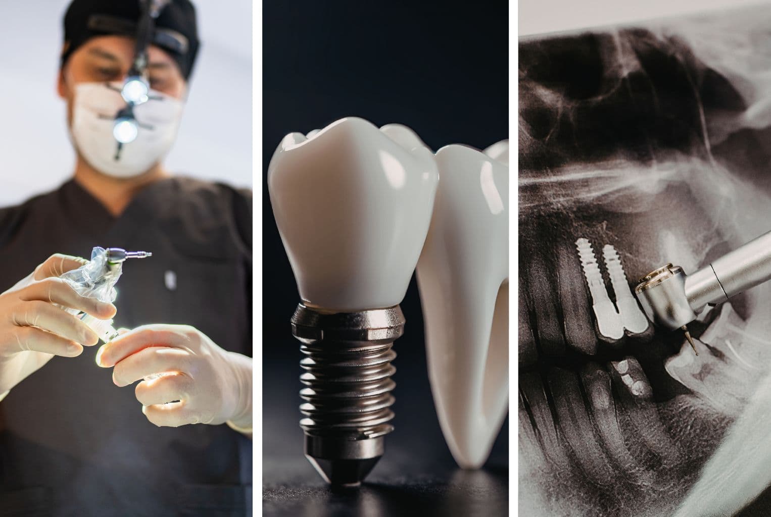 Імплантація зубів у Львові — сучасний титановий імплант та коронка